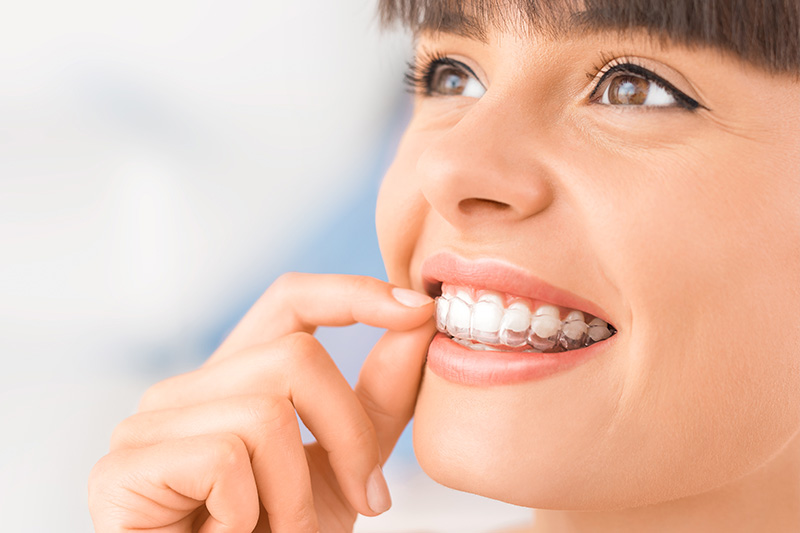 Invisalign in Phoenix