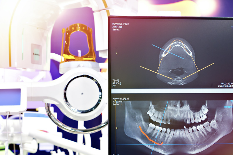 Digital X-Rays in Phoenix