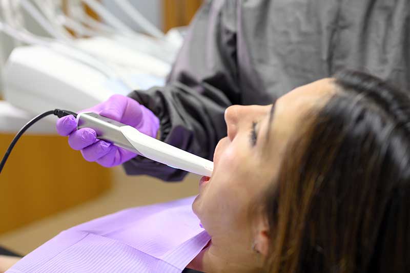 Intra-Oral Camera in Phoenix