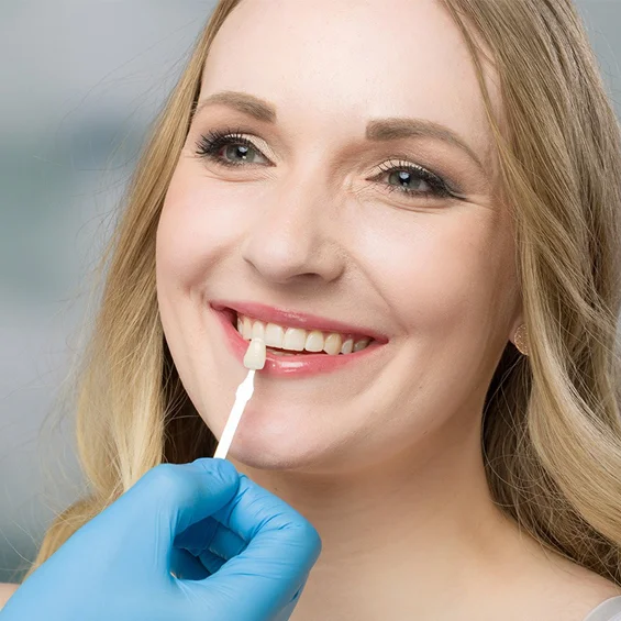 A woman with long blonde hair smiles as a person wearing blue gloves holds a dental veneers guide near her teeth to match.